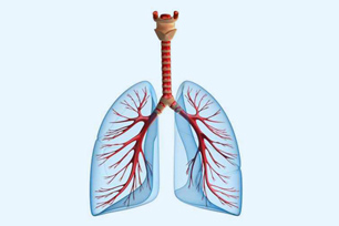 zystische Fibrose Mukovsizidose